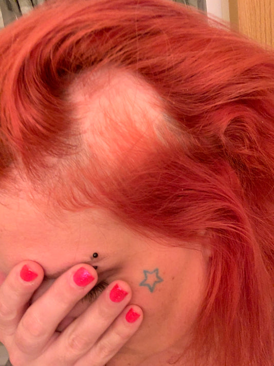 How it started. My story and hair journey.