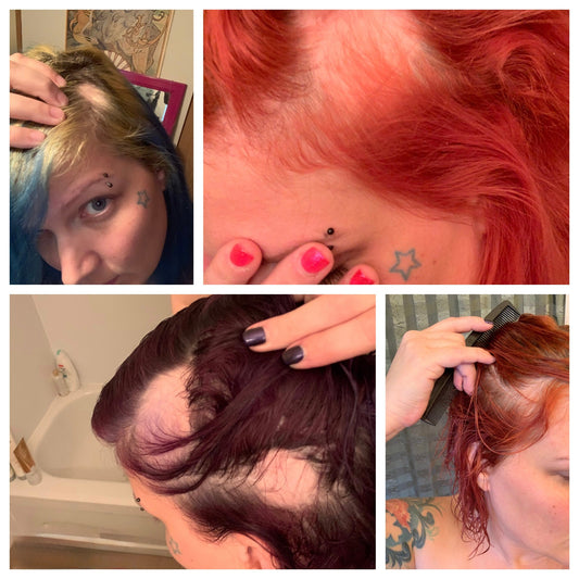 How it started. My story and hair journey.